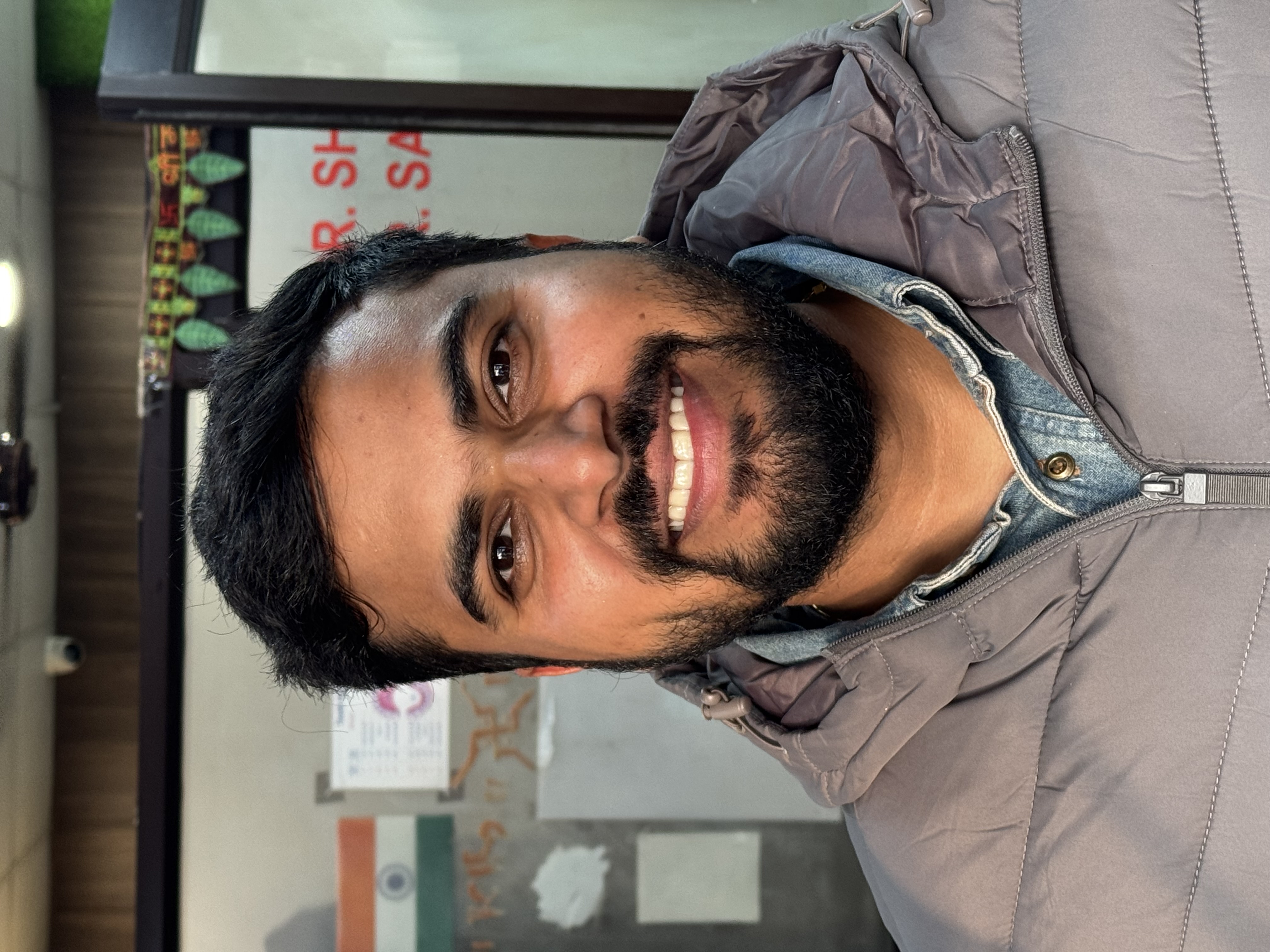 Post-treatment image after veneer closure of midline diastema